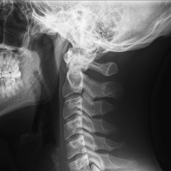 Yoga for Healthy Necks Workshop